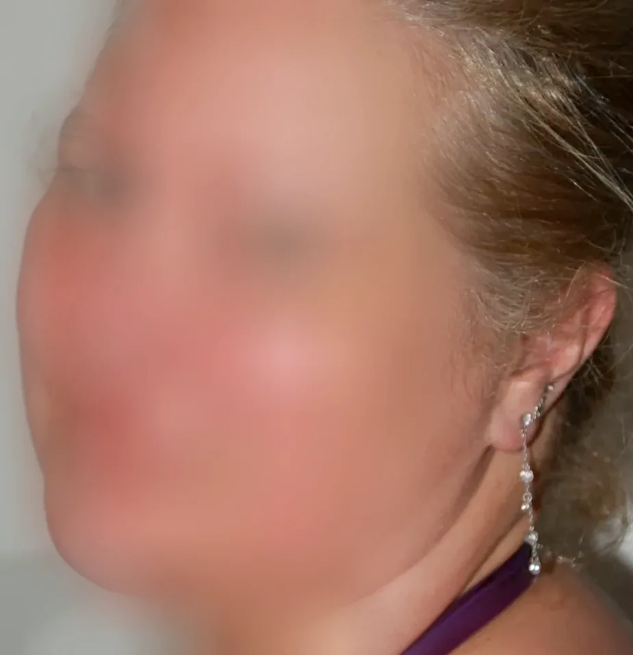 Farah, 28